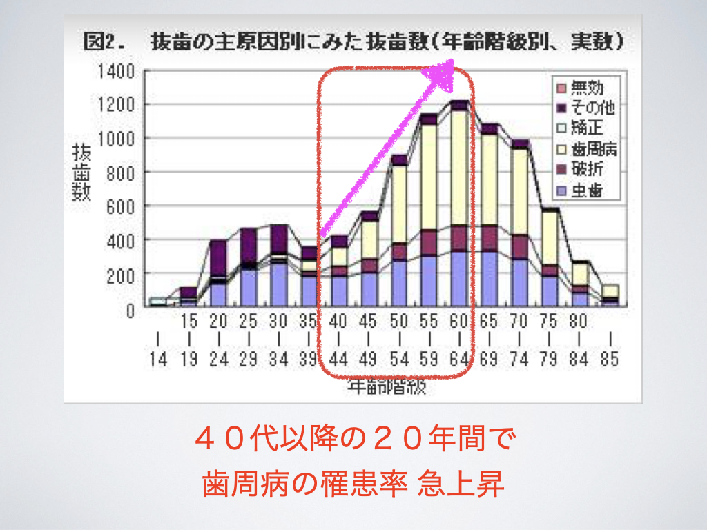 歯周病とは